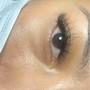 Eyelash Extension Removal