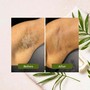 Brazilian Wax, Vajacial