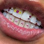 Teeth Whitening (30 Minute Session)