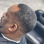 Men's Hair Replacement Virtual Consultation