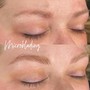 Microdermabrasion facial