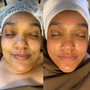 Yoni Facial