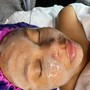 Acne Back Facial