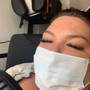 Dermaplaning facial treatment