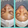 Enzyme Peel