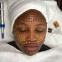 Dermaplaning