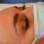 Microdermabrasion Facial