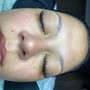 Dermaplaning Facial