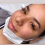 *SALE!—Dermaplaning Facial treatment