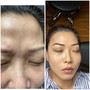 Eyebrow: Microblading