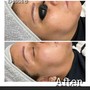 Custom Facial