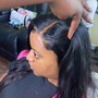 Scalp Treatment