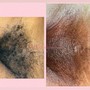 VAJACIAL + Brazilian Wax (Must Be 18+)