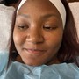 Hair restoration for edges or scalp