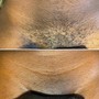 Chin/Neck Wax for course hair