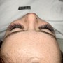 Eyelash Extension Removal