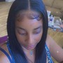 Scalp Treatment