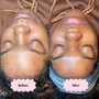 Back Facial Treatment