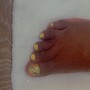 Pedicure