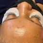 Eyelash Extension Removal