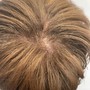 Rosemary Scalp Treatment