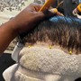 Scalp Treatment