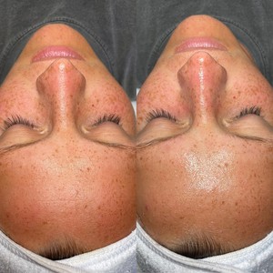 Dermaplaning Near Me Albany GA Appointments StyleSeat