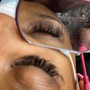 Eyelash Removal