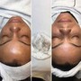 Eyelash Extension Removal