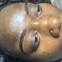 Chemical peel