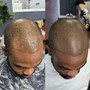 SCALP MICROPIGMENTATION [SMP] starting at $700 [CALL FOR ESTIMATE] AND BOOK APPOINTMENTS...200 DEPOSIT REQUIRED