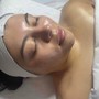 Signature facial (Microdermabrasion)