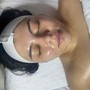 4 Microdermabrasion/ signature facial package