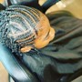 Scalp Treatment