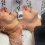 Back Facial