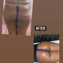 Buttocks enhancement + Toning