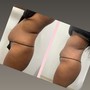 3Treatments Laser Lipo + Cavitation + tightening