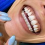 Teeth Whitening (120 Minute Session)