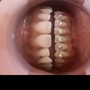 Teeth Whitening (120 Minute Session)