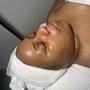 Dermaplaning Facial