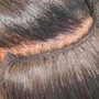 SCALP TREATMENT