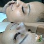 Eyebrow: Microblading