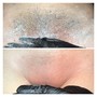 Brazilian Wax