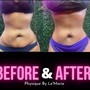 8 Body Contouring Sessions