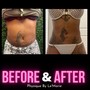 5 Body Contouring Sessions