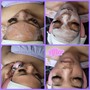 3 part Facial Series with 2  Modalities