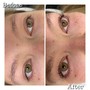 Under Eye Treatment