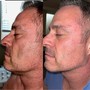 “The Works” Neurotris microcurrant face lift package of 3