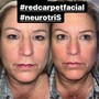 “The Works” Neurotris microcurrant face lift package of 3