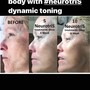 “The Works” Neurotris microcurrant face lift package of 3